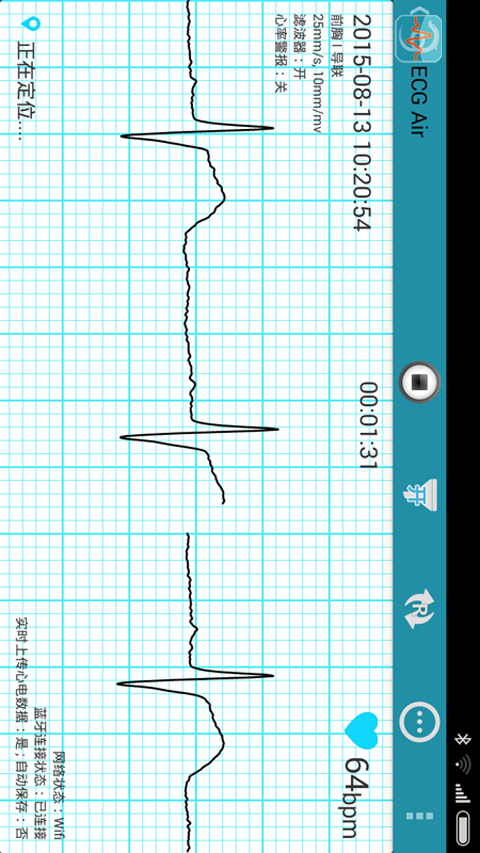 ECG Air截图1